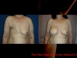 The Ohio State University Medical Center 