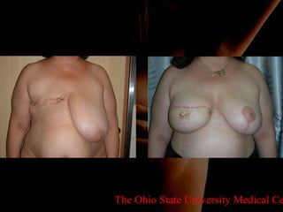 The Ohio State University Medical Center 