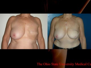 The Ohio State University Medical Center 