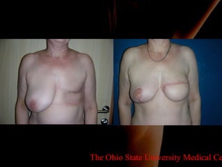 The Ohio State University Medical Center 