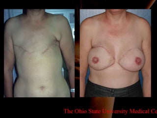 The Ohio State University Medical Center 