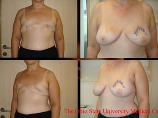 The Ohio State University Medical Center 