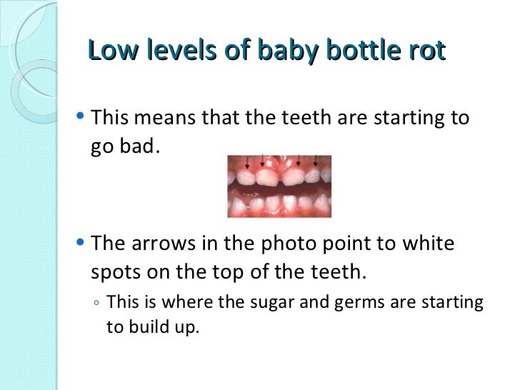 Zanzonico baby bottle rot