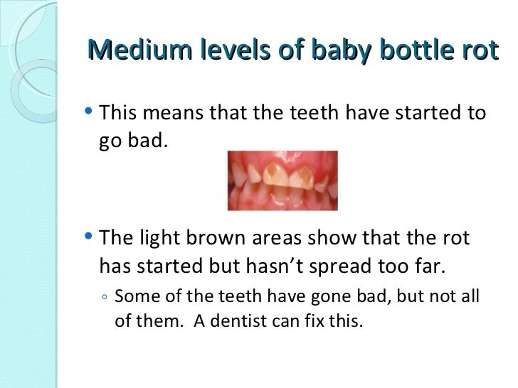 Zanzonico baby bottle rot