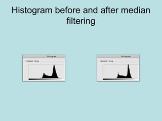 Histogram before and after median
filtering
 