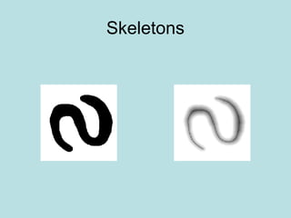 Skeletons
 