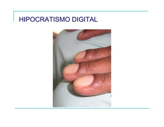 HIPOCRATISMO DIGITAL
 