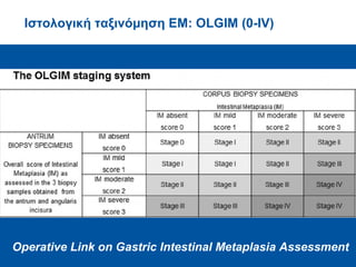 Ιστολογική ταξινόμηση ΕΜ: OLGIM (0-IV)
Operative Link on Gastric Intestinal Metaplasia Assessment
 