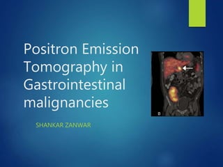Positron Emission
Tomography in
Gastrointestinal
malignancies
SHANKAR ZANWAR
 