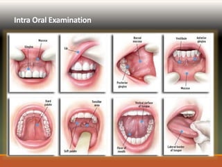 History and Examination of Prosthodontic Patient | PPTX