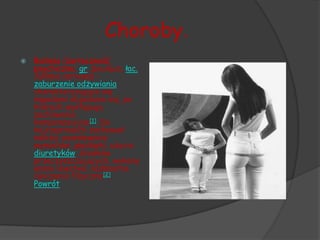 Choroby.
   Bulimia (żarłoczność
    psychiczna; gr. βουλῑμια, łac.
    būlīmia nervosa) –
    zaburzenie odżywiania
    charakteryzujące się
    napadami objadania się, po
    których występują
    zachowania
    kompensacyjne[1]. Do
    najczęstszych zachowań
    należą: wywoływanie
    wymiotów, głodówki, użycie
    diuretyków, środków
    przeczyszczających, wykony
    wanie lewatyw, nadmierne
    ćwiczenia fizyczne[2].
    Powrót
 