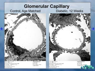 Blood Chemistry
26
43 45 47
0
10
20
30
Diabetic
Non-diabetic
* t-test
***
Age (weeks)
SerumBUN(mg/dL)
BUN
45 47
0.0
0.1
0.2
0.3
0.4
0.5
Diabetic
Non-diabetic
Age (weeks)
Serumcreatinine(mg/dL)
Creatinine
43 47
0
50
100
150
200
Diabetic
Non-diabetic
* t-test
**
Age (weeks)
Serumcholesterol(mg/dL)
Cholesterol
43 47
0
500
1000
1500
Diabetic
Non-diabetic
* t-test
**
Age (weeks)
Serumtriglycerides(mg/dL)
Triglyceride
 