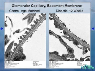 47 Week-old, 27 Weeks Diabetes
Non-Diabetic Diabetic
Diabetic Diabetic
27
 