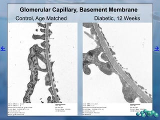 28
47 Week-old, 27 Weeks Diabetes
28
Non-Diabetic Diabetic
 