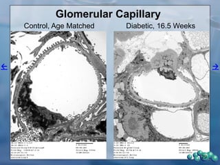 47 Week-old, 27 Weeks Diabetes
29
Non-Diabetic Diabetic
 