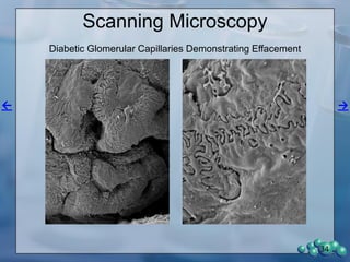 Protein Expression in the ZDSD
Glomerulus
34
 