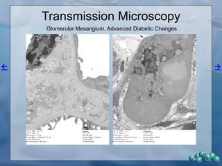 Protein Expression in the ZDSD
Glomerulus
35
 