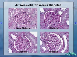 Data following 4 weeks of treatment. The change in urinary albumin was greater in
vehicle animals when they had a shorter duration of diabetes since they had lower
urinary albumin levels before treatment started. Asterisks* represent significant
effects of Lisinopril compared to vehicle.
Percent change of urinary albumin level
is dependent on duration of diabetes,
The effect of Lisinopril on nephropathy in the ZDSD rat
13 9 5
-200
0
200
400
600
800
% Change in UA
Weeks of Diabetes Before Treatment
UrinaryAlbumin
(%changefrombaseline) Vehicle
Lisinopril
N=3 3 4 5 5 5
* * *
42
 
