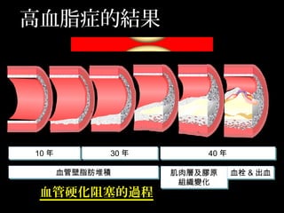 血管硬化阻塞的過程
10 年10 年 30 年30 年 40 年40 年
血管壁脂肪堆積血管壁脂肪堆積 肌肉層及膠原
組織變化
肌肉層及膠原
組織變化
血栓 & 出血血栓 & 出血
高血脂症的結果
 
