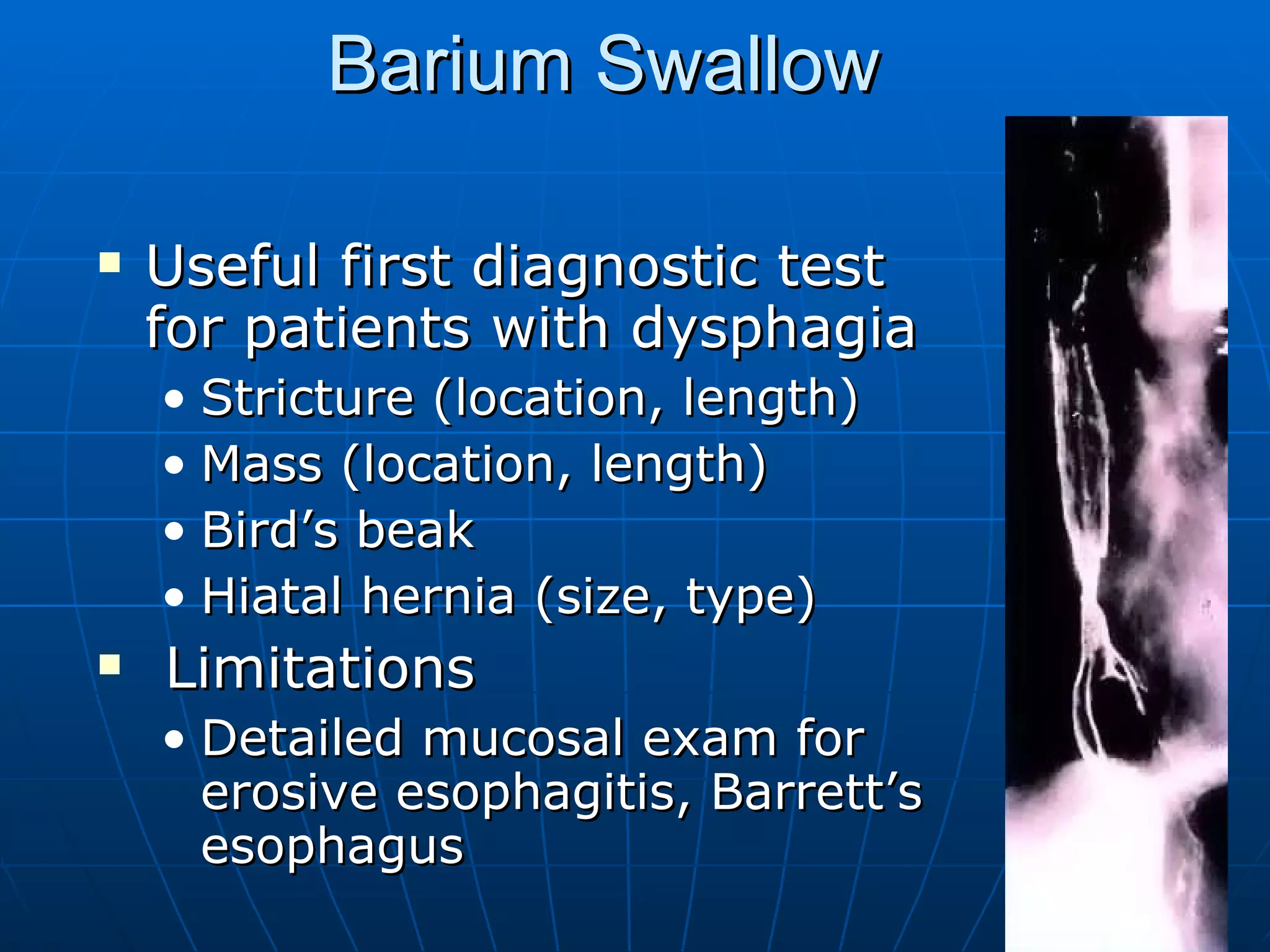 Barium Swallow Useful first diagnostic test for patients with dysphagia Stricture (location, length) Mass (location, length) Bird’s beak Hiatal hernia (size, type) Limitations Detailed mucosal exam for erosive esophagitis, Barrett’s esophagus 