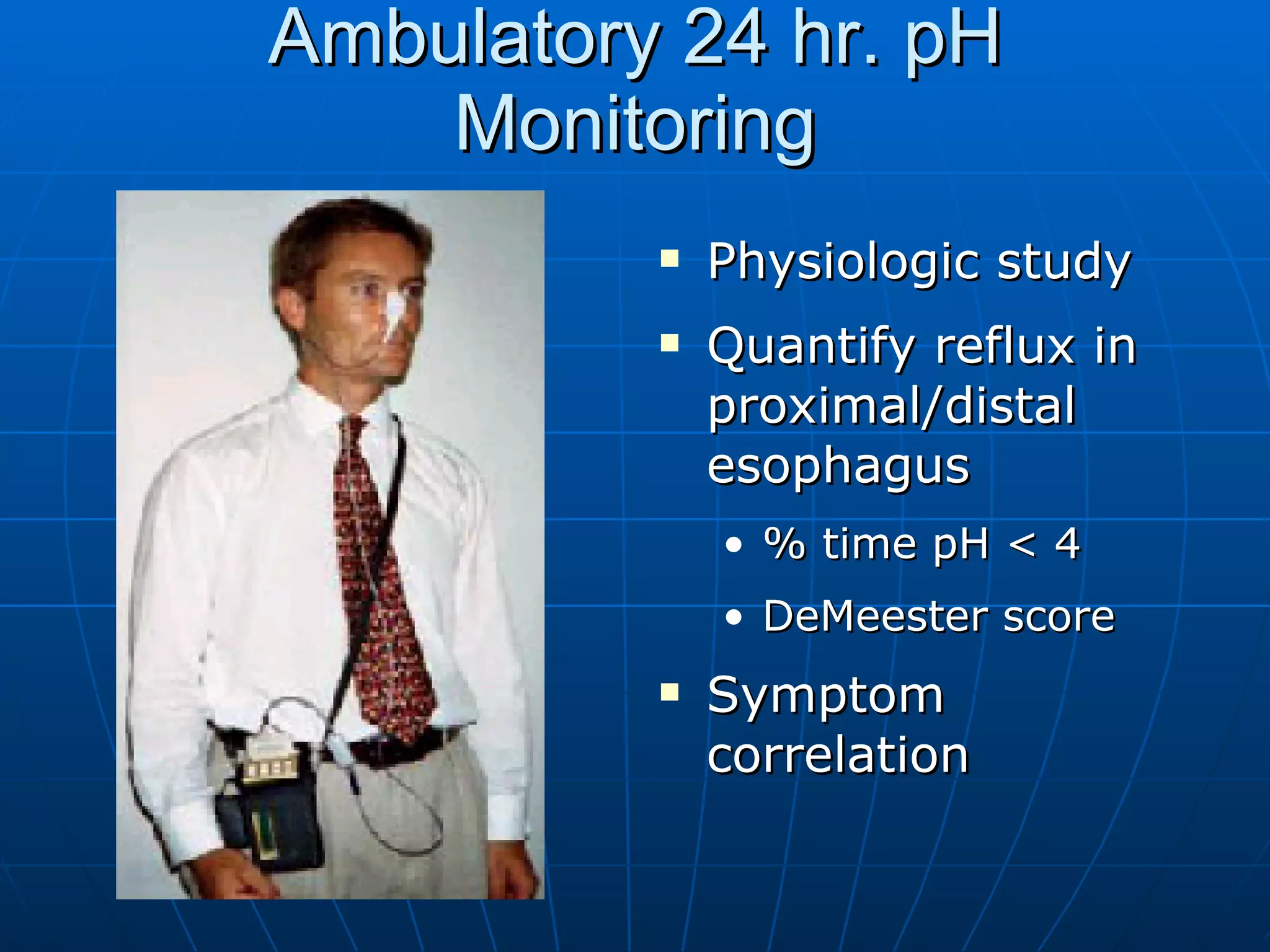 Ambulatory 24 hr. pH Monitoring Physiologic study Quantify reflux in proximal/distal esophagus % time pH < 4 DeMeester score Symptom correlation 