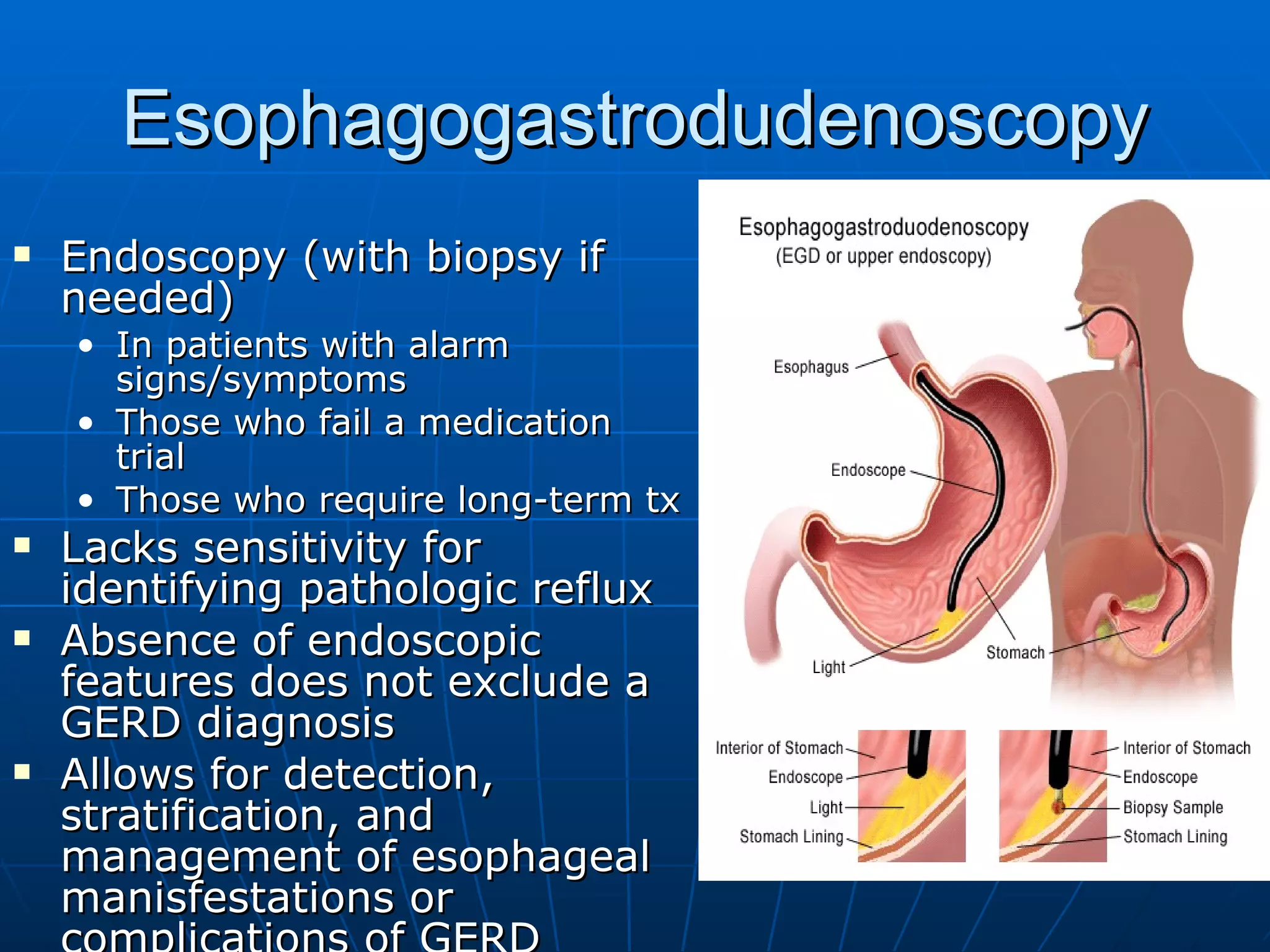 Esophagogastrodudenoscopy Endoscopy (with biopsy if needed) In patients with alarm signs/symptoms Those who fail a medication trial Those who require long-term tx Lacks sensitivity for identifying pathologic reflux Absence of endoscopic features does not exclude a GERD diagnosis Allows for detection, stratification, and management of esophageal manisfestations or complications of GERD 
