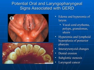 Potential Oral and Laryngopharyngeal Signs Associated with GERD Edema and hyperemia of larynx Vocal cord erythema, polyps, granulomas, ulcers Hyperemia and lymphoid hyperplasia of posterior pharynx  Interarytenyoid changes Dental erosion Subglottic stenosis Laryngeal cancer 