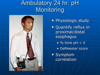 Ambulatory 24 hr. pH Monitoring Physiologic study Quantify reflux in proximal/distal esophagus % time pH < 4 DeMeester score Symptom correlation 