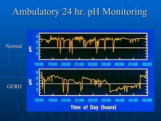 Ambulatory 24 hr. pH Monitoring Normal GERD 