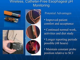 Wireless, Catheter-Free Esophageal pH Monitoring Improved patient comfort and acceptance Continued normal work, activities and diet study Longer reporting periods possible (48 hours) Maintain constant probe position relative to SCJ Potential Advantages 