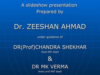 A slideshow presentation  Prepared by Dr. ZEESHAN AHMAD under guidance of DR(Prof)CHANDRA SHEKHAR Head ENT deptt & DR MK VERMA Assoc prof ENT deptt THANK YOU 