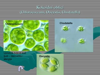 Kokoidni obliciKokoidni oblici
(Chlorococcum, Oocystis, Chodatella)(Chlorococcum, Oocystis, Chodatella)
Chlorococcum Chodatella
Oocystis
Uzročnik bolesti kod
ljudi – dermatitis i
alergija
 