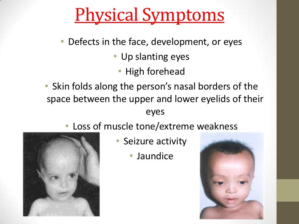 Zellweger syndrome
