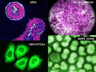 SIDA HEPATITISA GRIPE AVIAR NILOKO BIRUSA 