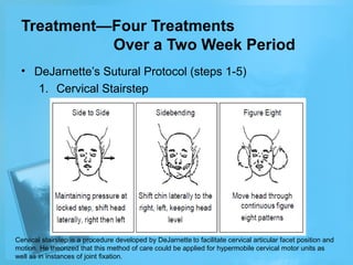 Treatment—Four Treatments
Over a Two Week Period
• DeJarnette’s Sutural Protocol (steps 1-5)
1. Cervical Stairstep

Cervical stairstep is a procedure developed by DeJarnette to facilitate cervical articular facet position and
motion. He theorized that this method of care could be applied for hypermobile cervical motor units as
well as in instances of joint fixation.

 