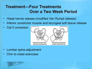 Treatment—Four Treatments
Over a Two Week Period
• Hiatal hernia release (modified Van Rumpt release)
• Inferior constrictor muscle and laryngeal soft tissue release
• Cat II correction

• Lumbar spine adjustment
• Chin to chest exercises

 