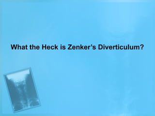 What the Heck is Zenker’s Diverticulum?

 