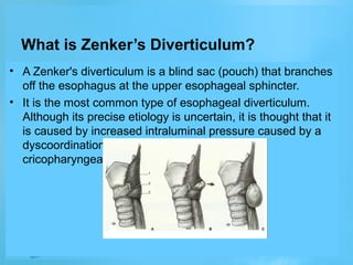 What is Zenker’s Diverticulum?
• A Zenker's diverticulum is a blind sac (pouch) that branches
off the esophagus at the upper esophageal sphincter.
• It is the most common type of esophageal diverticulum.
Although its precise etiology is uncertain, it is thought that it
is caused by increased intraluminal pressure caused by a
dyscoordination of pharyngeal contraction and
cricopharyngeal relaxation.

 