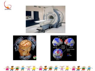 Tomografia por Emissão de Pósitrons (PET)Imagens seccionais do cérebro vivoUsa cores para representar diferentes graus de atividade. 1973 - Universidade de Washington em St. Louis, EUA