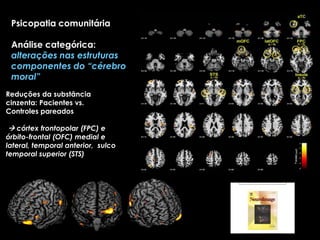 Estudo de caso-controle: 15 pacientes da amostra comunitária com altos escores no PCL:SV comparados a 15 controles normais Psychopathy Checklist, screening version (PCL:SV)