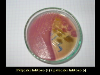 Pałęczki laktozo (+) i pałeczki laktozo (-)
 
