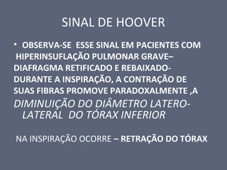SINAL DE HOOVER
• OBSERVA-SE ESSE SINAL EM PACIENTES COM
HIPERINSUFLAÇÃO PULMONAR GRAVE–
DIAFRAGMA RETIFICADO E REBAIXADO-
DURANTE A INSPIRAÇÃO, A CONTRAÇÃO DE
SUAS FIBRAS PROMOVE PARADOXALMENTE ,A
DIMINUIÇÃO DO DIÂMETRO LATERO-
LATERAL DO TÓRAX INFERIOR
NA INSPIRAÇÃO OCORRE – RETRAÇÃO DO TÓRAX
 