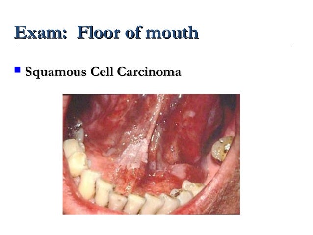 Examination Of The Oral Cavity