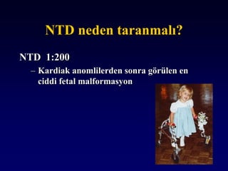 NTD neden taranmalı?
NTD 1:200
– Kardiak anomlilerden sonra görülen en
ciddi fetal malformasyon
 