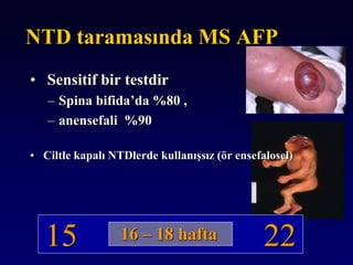 15 22
NTD taramasında MS AFP
• Sensitif bir testdir
– Spina bifida’da %80 ,
– anensefali %90
• Ciltle kapalı NTDlerde kullanışsız (ör ensefalosel)
16 – 18 hafta
 
