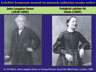 Gebelikte kromozom anomali taramasında kullanılan tarama testleri
 