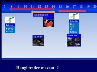 7 8 9 10 11 12 13 14 15 16 17 18 19 20
Kombine test
İkili test
F-ᵦHcg
PAPP-A
Genetık Sono
NT
NB-DV-TY
2trim Bio
lu testHcg
AFP
uE
Inhibin
Hangi testler mevcut ?
 