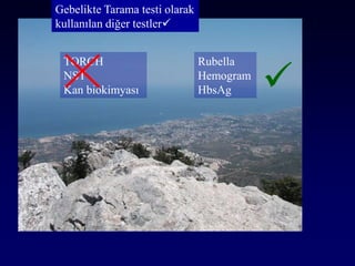 Gebelikte Tarama testi olarak
kullanılan diğer testler
TORCH
NST
Kan biokimyası
Rubella
Hemogram
HbsAg 
 