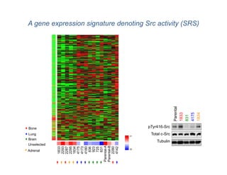 A gene expression signature denoting Src activity (SRS)




                                                     Parental
                                                     1833

                                                     4175
                                                     1834
                                                     831
Bone                                  pTyr416-Src
Lung                                   Total c-Src
                                1


Brain
                                          Tubulin
Unselected
             Parental-A
             Parental-B
                 2295
                 1833
                 2293


                 1834
                 4175
                 4173
                 4180




                 2280
                 4142
                 2287




                   923
                   836

                   725
                   831




                                0




Adrenal
 
