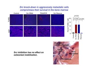 Src knock-down in aggressively metastatic cells
                  compromises their survival in the bone marrow
        Control         Src RNAi     Dasatinib    Src Rescue
                                                                                                           p=0.02
TUNEL




                                                                                            20     p=0.005 p=0.003




                                                                     Percent TUNEL+ cells
                                                                                            15

                                                                                            10

                                                                                             5
Ki67




                                                                                             0




                                                                                                 Control
                                                                                                            Src RNAi
                                                                                                                       Dasatinib
                                                                                                                                   Rescued
                                                   Bone met
                                                   microenvironment

                                                      Cancer
                                                       Cells                                   Bone
        Src inhibition has no effect on
                                                                                            degradation
        osteoclast mobilization.
                                                               Osteoclasts
 